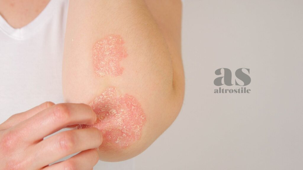 AltroStile • 8 segnali che il tuo intestino sta chiedendo aiuto