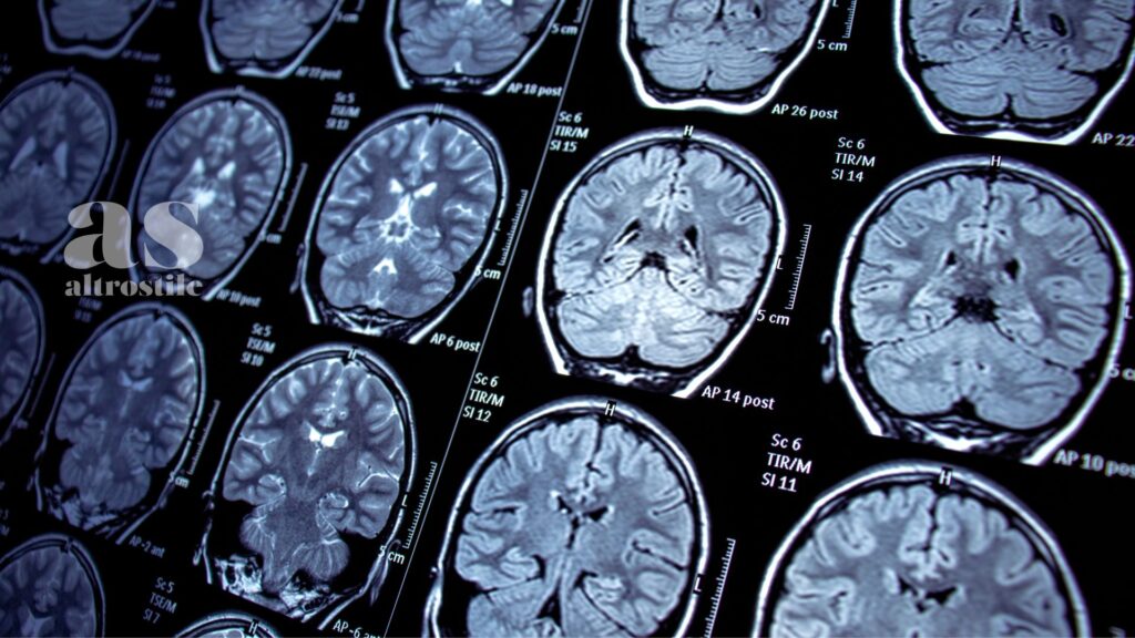 AltroStile • La bussola del cervello umano: la "guida interna" che punta sempre a Nord