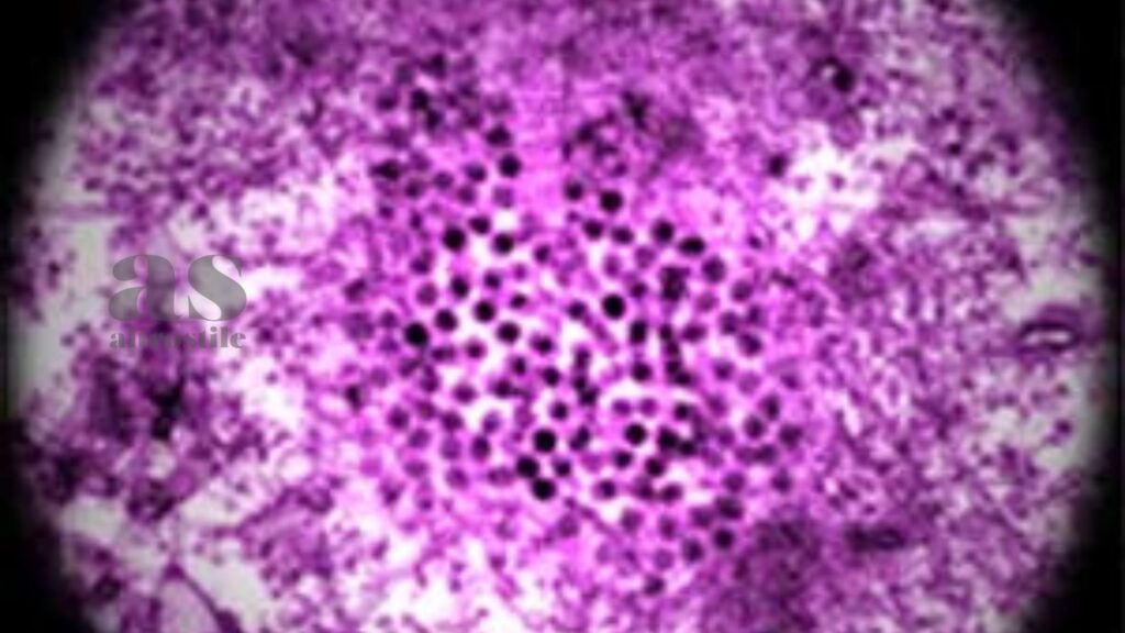 AltroStile • West Nile Virus 2025: Cosa Sapere per Proteggersi e Vivere l’Estate in Sicurezza
