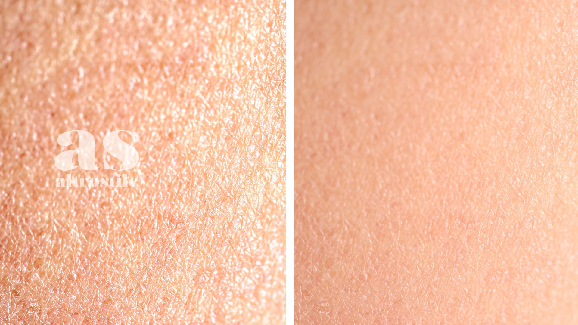 AS • Benessere AS • Benessere