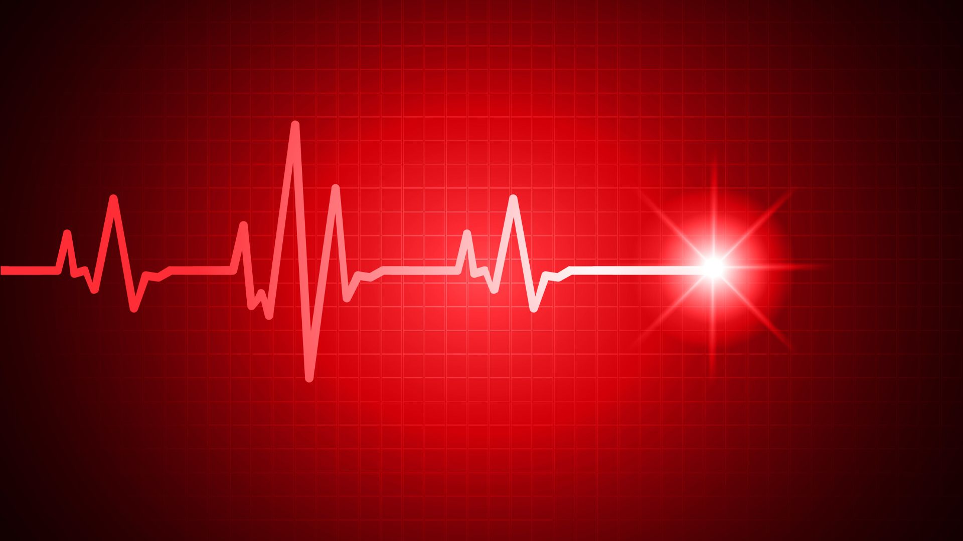HRV