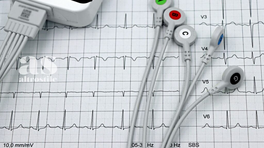 AS • HRV: come leggere il codice segreto del tuo sistema nervoso per gestire lo stress AS • HRV: come leggere il codice segreto del tuo sistema nervoso per gestire lo stress