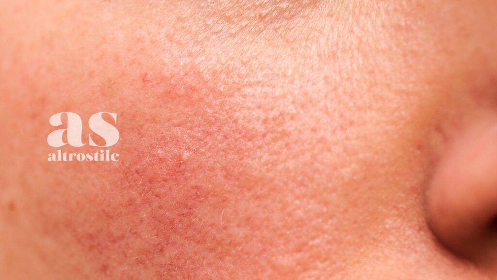 AS • Pelle e Salute: la guida per leggere, riparare e rigenerare la pelle AS • Pelle e Salute: la guida per leggere, riparare e rigenerare la pelle