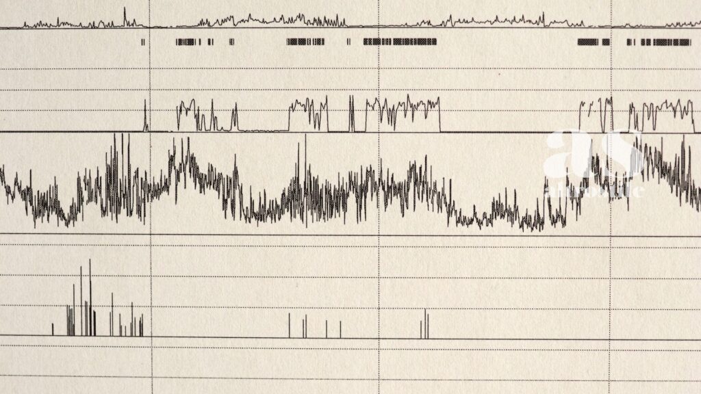 AS • Cos'è lo Sleep Tourism: perché stiamo iniziando a viaggiare per dormire AS • Cos'è lo Sleep Tourism: perché stiamo iniziando a viaggiare per dormire